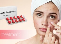 Isotroin 20 for acne and acne scars